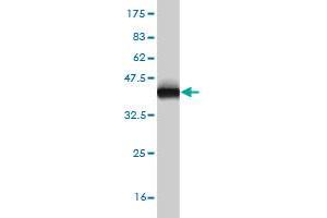 Western Blot detection against Immunogen (36. (ECH1 antibody  (AA 21-120))