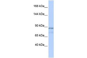 WB Suggested Anti-ZFAT1 Antibody Titration:  0. (ZFAT antibody  (Middle Region))