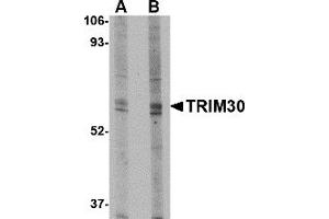 Western Blotting (WB) image for anti-Tripartite Motif Containing 30 (Trim30) (N-Term) antibody (ABIN1031643) (TRIM30 antibody  (N-Term))