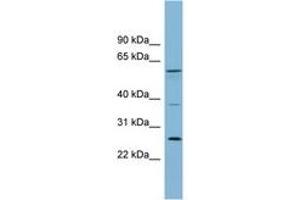 GDAP2 antibody  (AA 143-192)