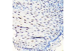 Immunohistochemistry of paraffin-embedded human esophageal using GTPBP4 Rabbit pAb (ABIN1680142, ABIN3019054, ABIN3019055 and ABIN6220689) at dilution of 1:50 (40x lens).