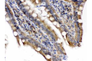 Immunohistochemistry (IHC) image for anti-Talin 2 (TLN2) (AA 1787-1822), (Middle Region) antibody (ABIN4886745)