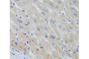Immunohistochemistry of paraffin-embedded Human liver using PTTG1 Polyclonal Antibody at dilution of 1:100 (40x lens). (PTTG1 antibody)