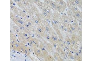 Immunohistochemistry of paraffin-embedded Human liver using PTTG1 Polyclonal Antibody at dilution of 1:100 (40x lens).