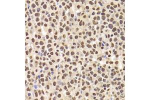 Immunohistochemistry (Paraffin-embedded Sections) (IHC (p)) image for anti-Acidic (Leucine-Rich) Nuclear phosphoprotein 32 Family, Member A (ANP32A) (AA 1-170) antibody (ABIN6136909)