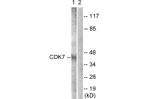 Immunohistochemistry analysis of paraffin-embedded human breast carcinoma tissue using CDK7 (Ab-170) antibody. (CDK7 antibody  (Thr170))