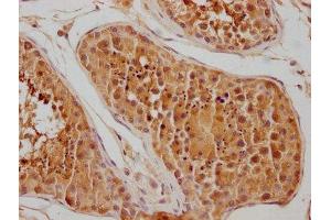 IHC image of ABIN7154847 diluted at 1:100 and staining in paraffin-embedded human testis tissue performed on a Leica BondTM system. (HSPA1L antibody  (AA 420-641))