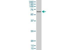 PPARD monoclonal antibody (M03), clone 1G4 Western Blot analysis of PPARD expression in K-562 . (PPARD antibody  (AA 56-165))