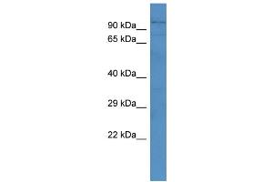 Western Blotting (WB) image for anti-ADAM Metallopeptidase with Thrombospondin Type 1 Motif, 4 (ADAMTS4) (N-Term) antibody (ABIN2776876)