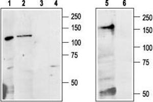 Western blot analysis of Colo205 (lanes 1 and 3), rat liver (lanes 2 and 4) and mouse kidney (lanes 5 and 6) lysates: - 1,2,5. (CASR antibody  (Extracellular, N-Term))