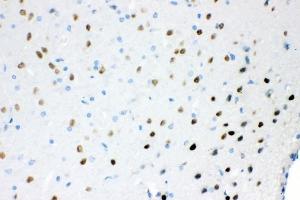 IHC analysis of Ataxin 1 using anti-Ataxin 1 antibody (ABIN3043506). (Ataxin 1 antibody  (C-Term))