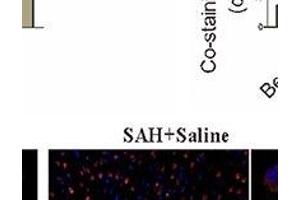 Autophagy of mice brain and neuron with the administration of COG1410. (LC3B antibody)