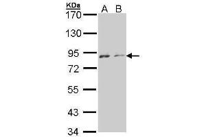 WB Image Sample (30 ug of whole cell lysate) A: A431 , B: H1299 7. (NEK4 antibody)