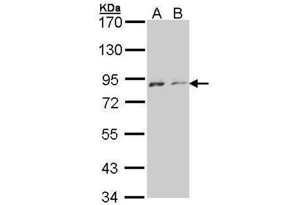 NEK4 anticorps