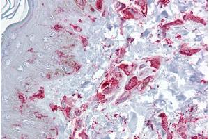 Immunohistochemistry with Skin, dermal fibroblasts tissue at an antibody concentration of 5µg/ml using anti-ZFP36L2 antibody (ARP33383_P050) (ZFP36L2 antibody  (N-Term))
