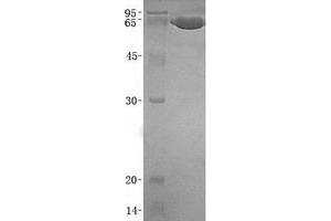 Validation with Western Blot (MMP2 Protein (Transcript Variant 2) (His tag))