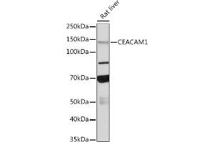 Western blot analysis of extracts of Rat liver, using CE antibody (ABIN7266083) at 1:500 dilution.