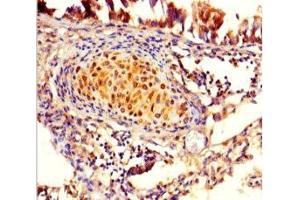 Immunohistochemistry of paraffin-embedded human lung tissue using ABIN7165430 at dilution of 1:100 (FAM161A antibody  (AA 1-300))