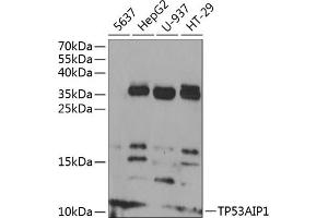 Western blot analysis of extracts of various cell lines, using TP53 antibody (ABIN6130604, ABIN6149410, ABIN6149412 and ABIN6218410) at 1:1000 dilution. (TP53AIP1 antibody  (AA 1-108))