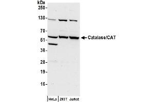 Western Blotting (WB) image for anti-Catalase (CAT) (AA 477-527) antibody (ABIN7449685)