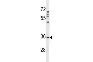 Aurora-C antibody western blot analysis in MDA-MB231 lysate. (Aurora Kinase C antibody  (AA 3-38))