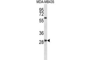 Western Blotting (WB) image for anti-SLAM Family Member 8 (SLAMF8) antibody (ABIN2997003) (SLAMF8 antibody)