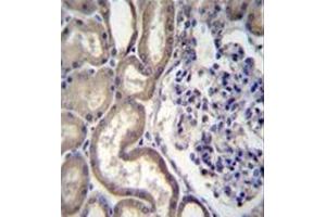 Formalin fixed, paraffin embedded human kidney tissue stained with STIM2 Antibody (N-term) followed by peroxidase conjugation of the secondary antibody and DAB staining. (Stim2 antibody  (N-Term))