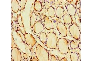 Immunohistochemistry of paraffin-embedded human thyroid tissue using ABIN7153535 at dilution of 1:100 (CRYGN antibody  (AA 1-182))