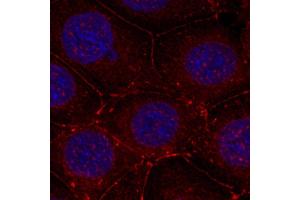 Immunofluorescence staining of methanol-fixed MCF7 cells using Phospho-IGF1R-Y1161 antibody. (IGF1R antibody  (pTyr1161))