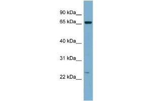 WB Suggested Anti-ZNF572 Antibody Titration:  0. (ZNF572 antibody  (Middle Region))