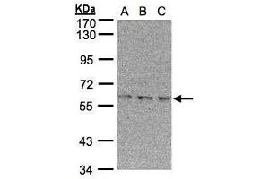 WB Image Sample(30 μg of whole cell lysate) A:293T B:A431, C:H1299 7. (EPM2AIP1 antibody  (N-Term))