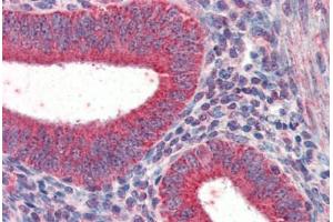 Human Uterus (formalin-fixed, paraffin-embedded) stained with TRIM5 antibody ABIN337284 at 5 ug/ml followed by biotinylated anti-goat IgG secondary antibody ABIN481715, alkaline phosphatase-streptavidin and chromogen. (TRIM5 antibody  (AA 2-15))