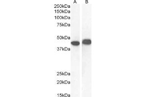 Western Blotting (WB) image for anti-alpha-Methylacyl-CoA Racemase (AMACR) (AA 312-326) antibody (ABIN2613380)