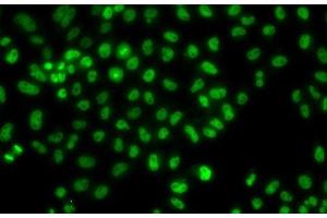 Immunofluorescence analysis of HeLa cells using LHX8 Polyclonal Antibody (LHX8 antibody)