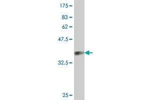 Western Blot detection against Immunogen (36. (SPG21 antibody  (AA 211-306))