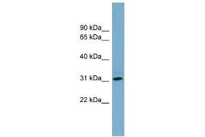 WB Suggested Anti-RNF144B Antibody Titration:  0. (RNF144B antibody  (Middle Region))