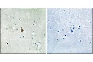 Immunohistochemistry analysis of paraffin-embedded human brain, using Trk C (Phospho-Tyr516) Antibody.