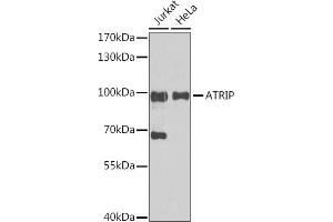 Western blot analysis of extracts of various cell lines, using ATRIP antibody (ABIN1678799, ABIN3019346, ABIN3019347 and ABIN6220835) at 1:1000 dilution. (ATRIP antibody  (AA 1-260))