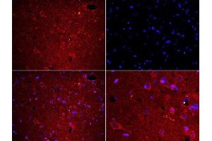 Formalin-fixed and paraffin embedded rat brain labeled with Rabbit Anti-Fibrinogen alpha chain Polyclonal Antibody, Unconjugated used at 1:200 dilution for 40 minutes at 37°C. (FGA antibody  (AA 61-160))