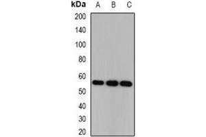 Western blot analysis of CSN1 expression in HEK293T (A), SKOV3 (B), mouse brain (C) whole cell lysates.