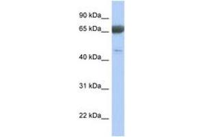 Image no. 1 for anti-Paraneoplastic Antigen MA3 (PNMA3) (AA 359-408) antibody (ABIN6743787) (PNMA3 antibody  (AA 359-408))