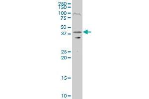 RRAGC polyclonal antibody (A01), Lot # 050801JC01 Western Blot analysis of RRAGC expression in Y-79 . (GTR2 antibody  (AA 1-399))