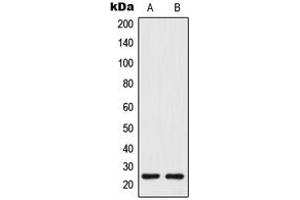 Western blot analysis of Tetraspanin 8 expression in human colon (A), COLO205 (B) whole cell lysates. (Tspan-8 antibody  (Center))