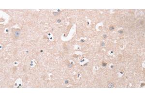 Immunohistochemistry of paraffin-embedded Human brain tissue using CDCA4 Polyclonal Antibody at dilution 1:50 (CDCA4 antibody)