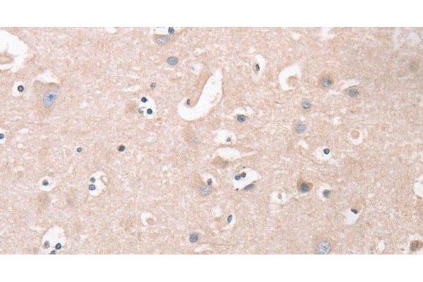 CDCA4 antibody