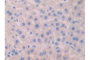 DAB staining on IHC-P; Samples: Mouse Liver Tissue (AGGF1 antibody  (AA 263-507))