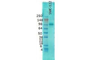 western rat membrane 1 in 1000 PSD 95 copy. (DLG4 antibody)