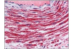 Immunohistochemistry (IHC) image for anti-Tissue Factor Pathway Inhibitor (Lipoprotein-Associated Coagulation Inhibitor) (TFPI) antibody (ABIN781815) (TFPI antibody)