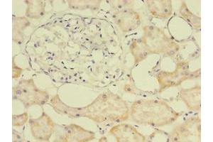 Immunohistochemistry of paraffin-embedded human kidney tissue using ABIN7172517 at dilution of 1:100 (E2F2 antibody  (AA 1-83))