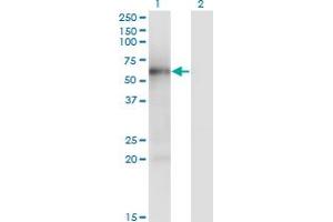 Western Blot analysis of MKNK1 expression in transfected 293T cell line by MKNK1 monoclonal antibody (M04), clone 5E12. (MKNK1 antibody  (AA 1-465))